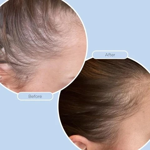 product-480-480 Minoxidil